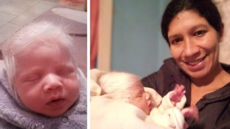 “Virou o xodó de todos”. Gauchinho albino surpreende ao nascer e encanta família