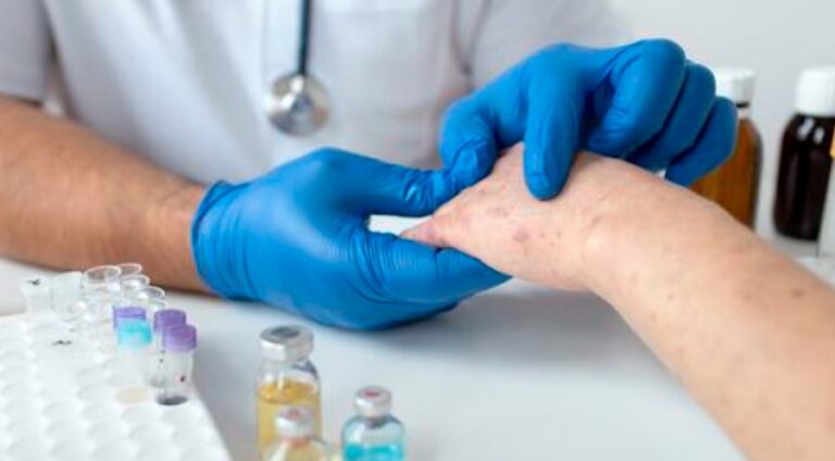Primeiro teste para diagnóstico da Monkeypox no Brasil é aprovado pela Anvisa
