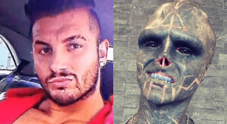 Homem passa por modificações corporais extremas para se tornar um “alien”