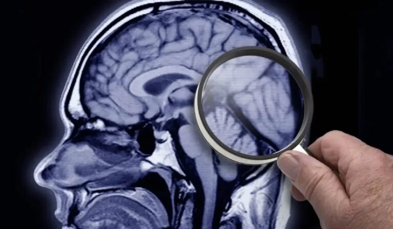 Alzheimer: IA identifica fatores de risco com 7 anos de antecedência