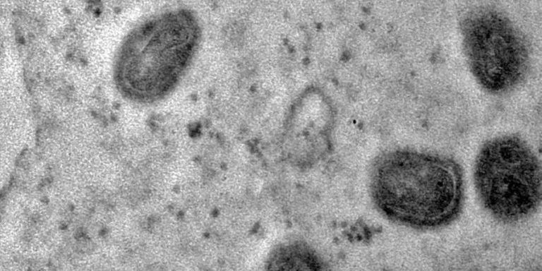 OMS aprova primeiro teste para diagnosticar mpox