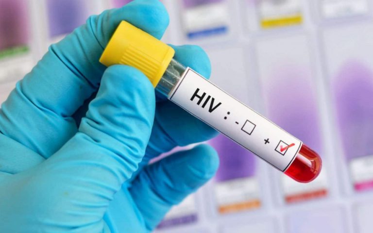Aids: Brasil tem alta de casos, mas menor mortalidade desde 2013