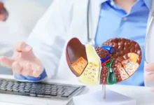 Cebolinha comum protege fígado contra gordura e inflamação