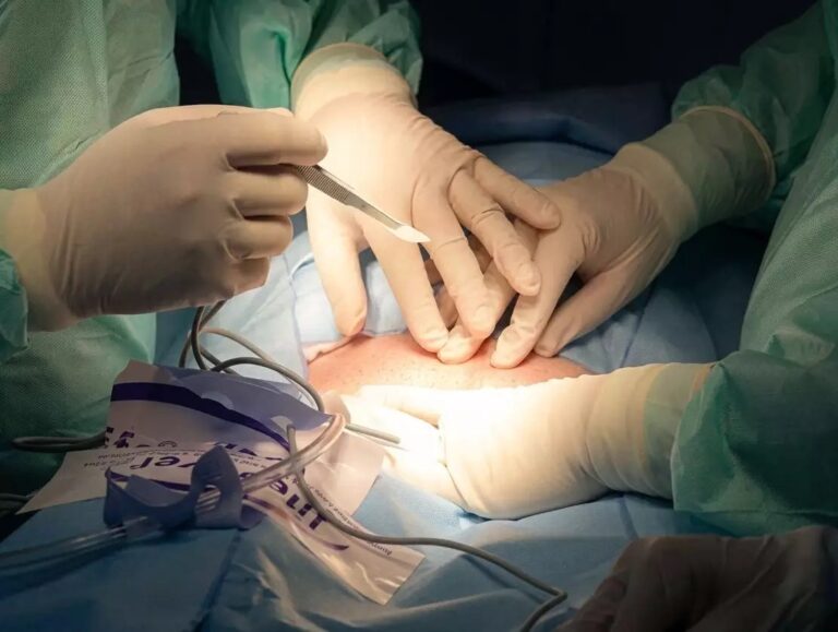 Justiça amplia indenização de paciente que teve compressa esquecida no abdômen em cirurgia