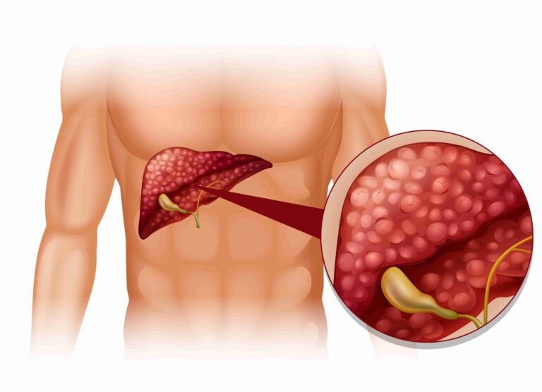Julho Amarelo alerta para diagnóstico precoce das hepatites virais